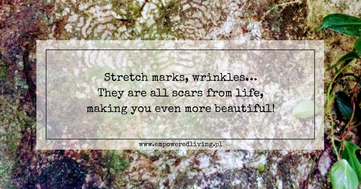 Stretch marks? YES, please!